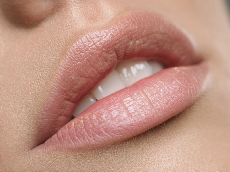 preenchimento labial em goiânia clínica faccia odontologia
